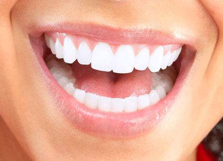 Smiling with Porcelain Veneers Woman Smiling with Veneers